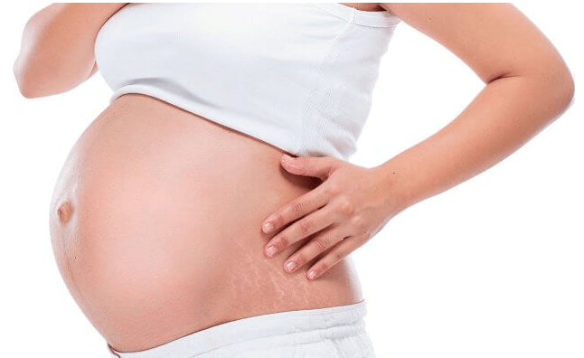 Dr James Stretch Mark Cream 200 ml