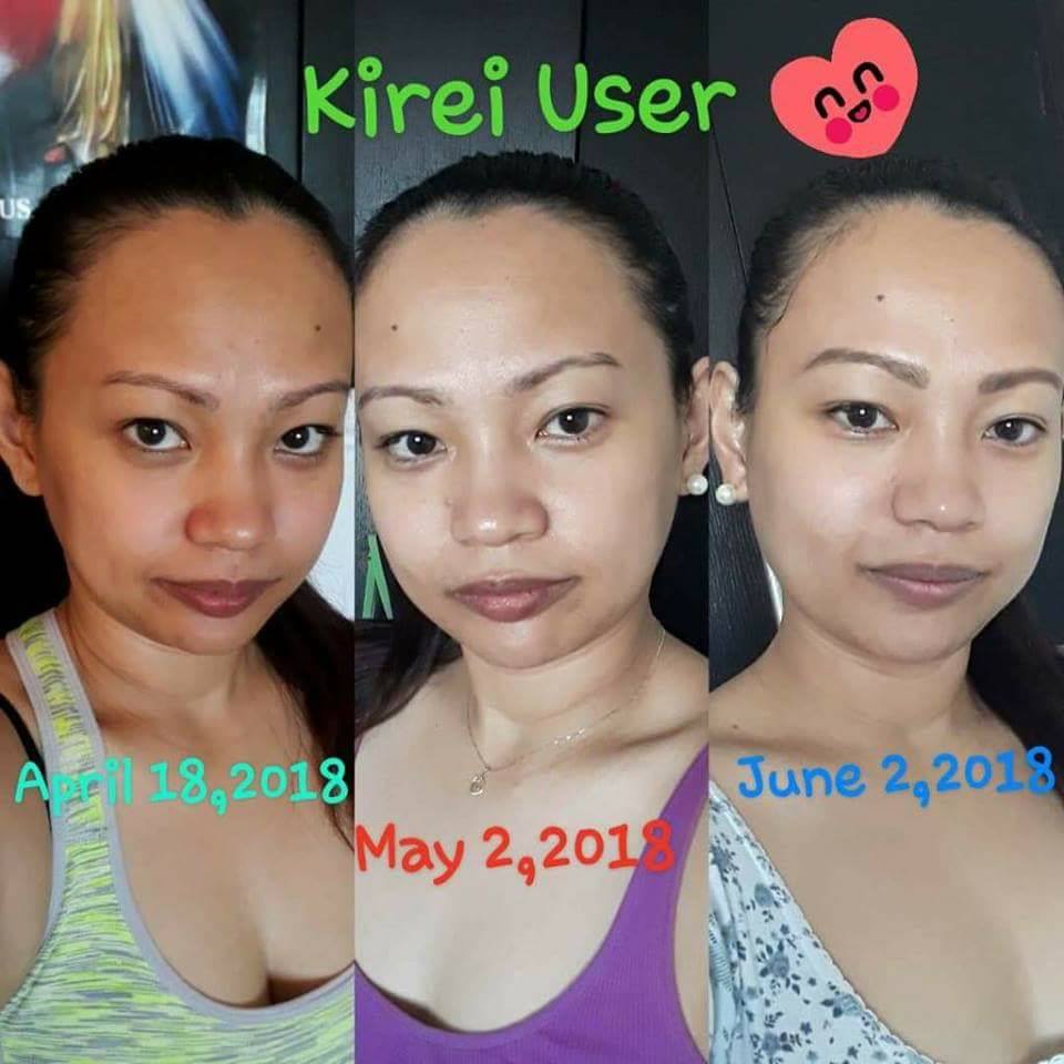 kirei glutathione review Antioxidant-Rich Foods to Grow for Immune Health main image 0